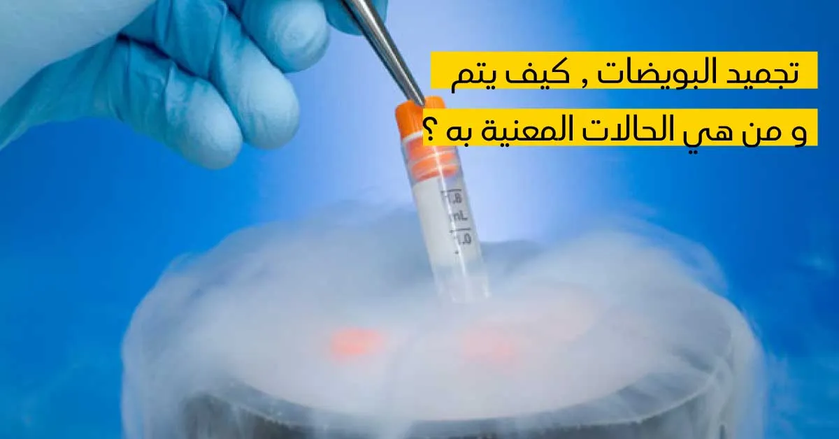  تجميد البويضات, كيف يتمّ ومن هي الحالات المعنيّة به ؟